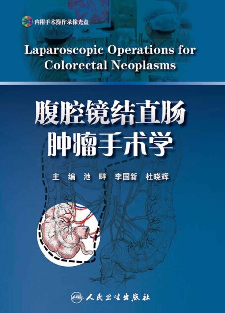 腹腔镜结直肠肿瘤手术学