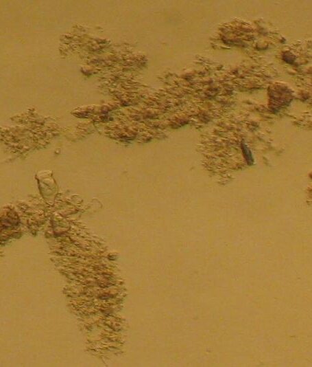 污水处理常见指示性微生物图谱