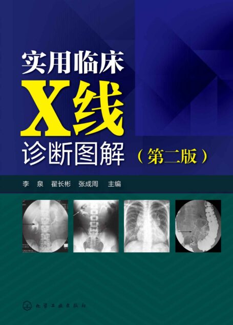 实用临床X线诊断图解(第二版)