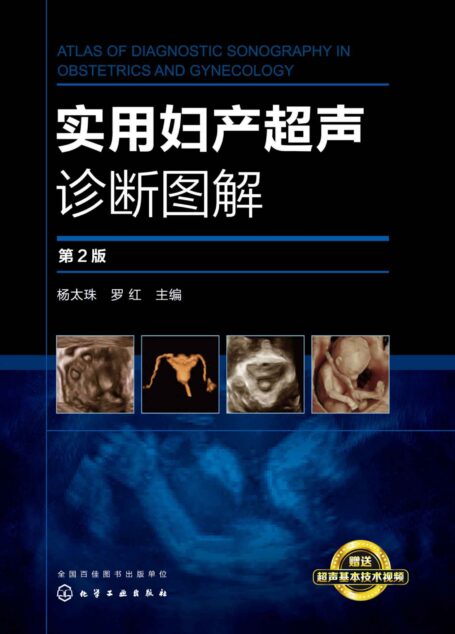 实用妇产超声诊断图解（第2版）