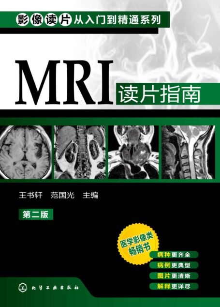 MRI读片指南 (影像读片从入门到精通系列)