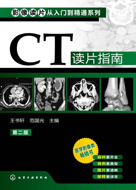 影像读片从入门到精通系列–CT读片指南(二版)