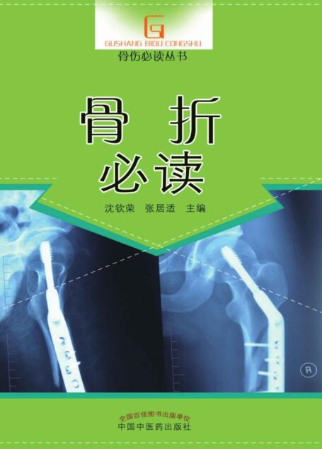 骨折必读 (骨伤必读丛书)