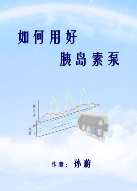 如何用好胰岛素泵