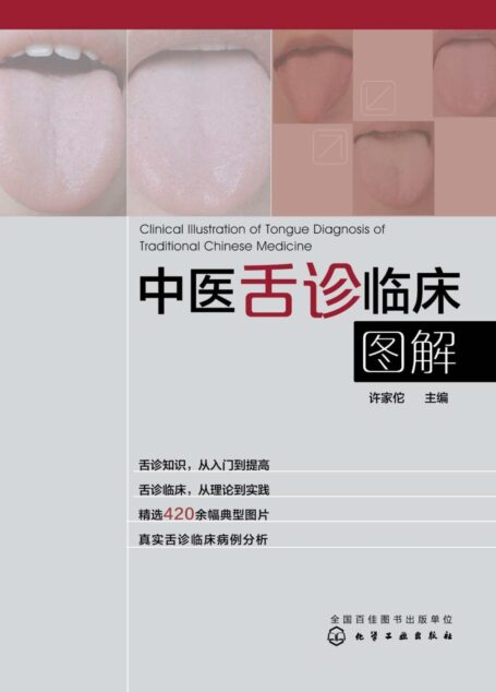 中医舌诊临床图解