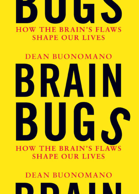 Brain Buys